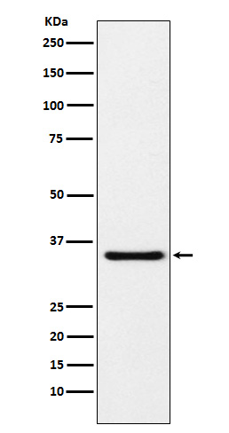 MDH1