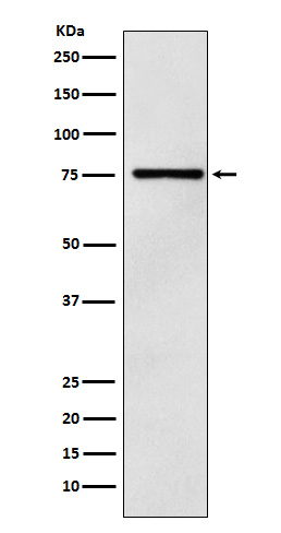 DCP1A