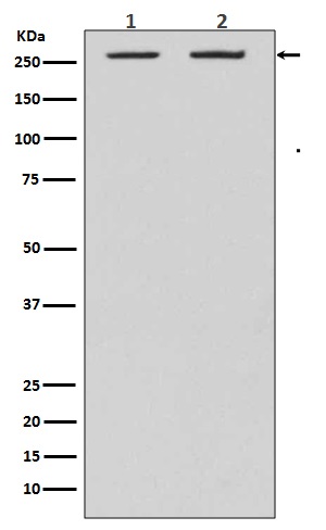 Acetyl Coenzyme A Carboxylase