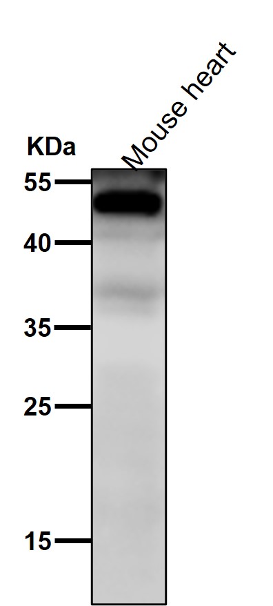 NFIB/NF1B2