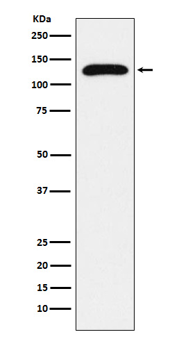 TRPC1