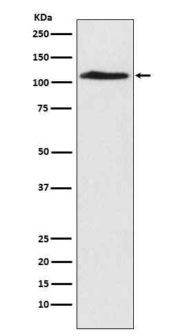CHD1L