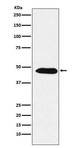 EBP1/PA2G4