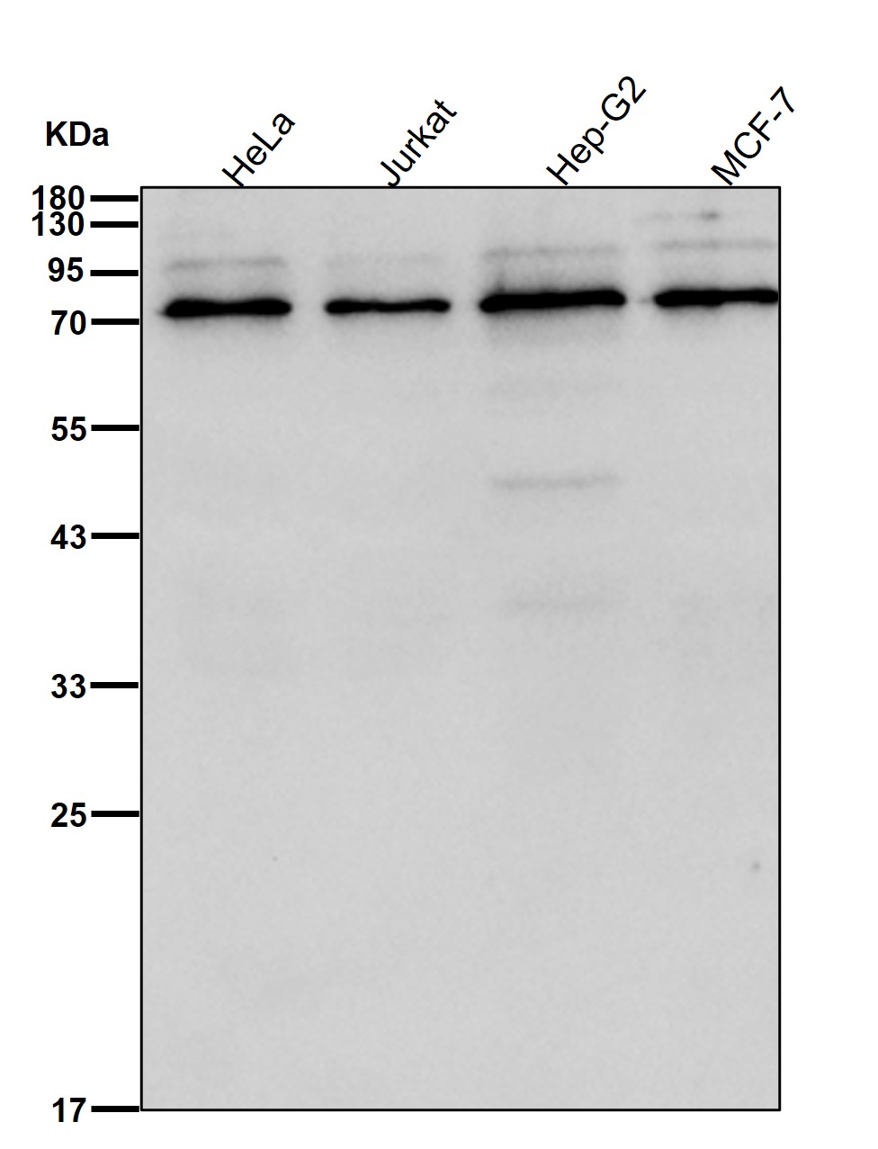 Rabbit Monoclonal to Furin