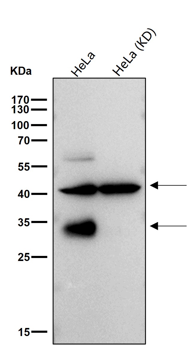 Rabbit Monoclonal to Legumain