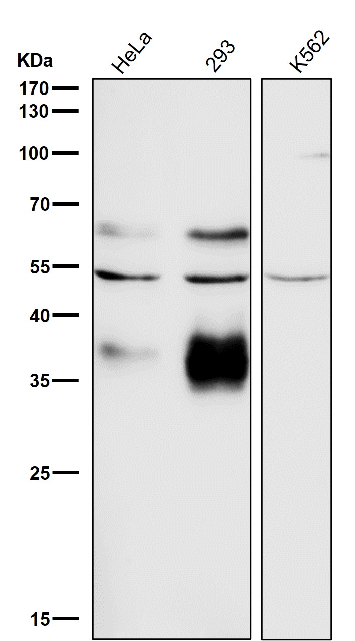 Rabbit Monoclonal to Legumain