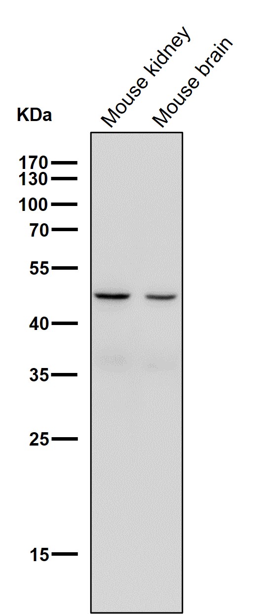 Rabbit Monoclonal to Legumain