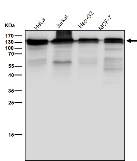 Rabbit Monoclonal to NEDD4