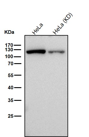 Rabbit Monoclonal to HLTF