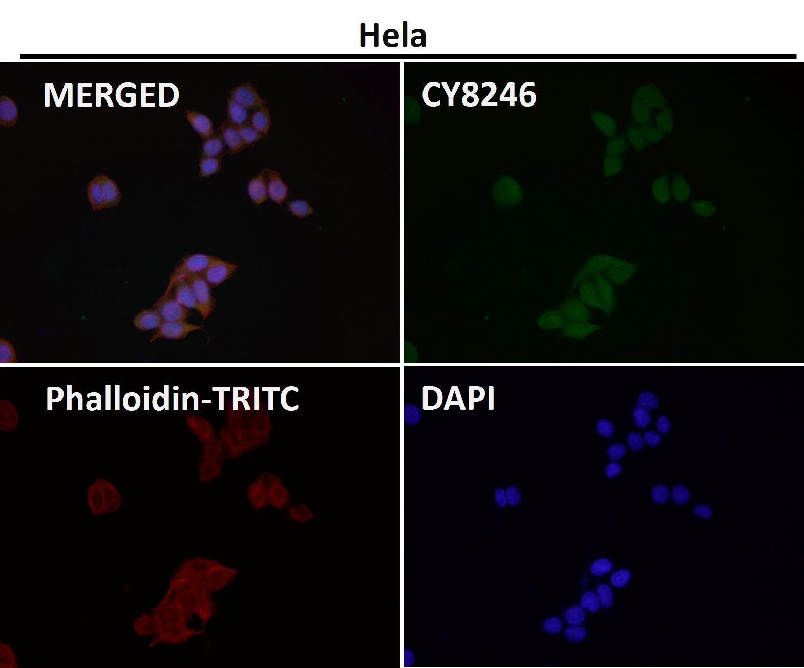 Rabbit Monoclonal to P70S6 Kinase beta