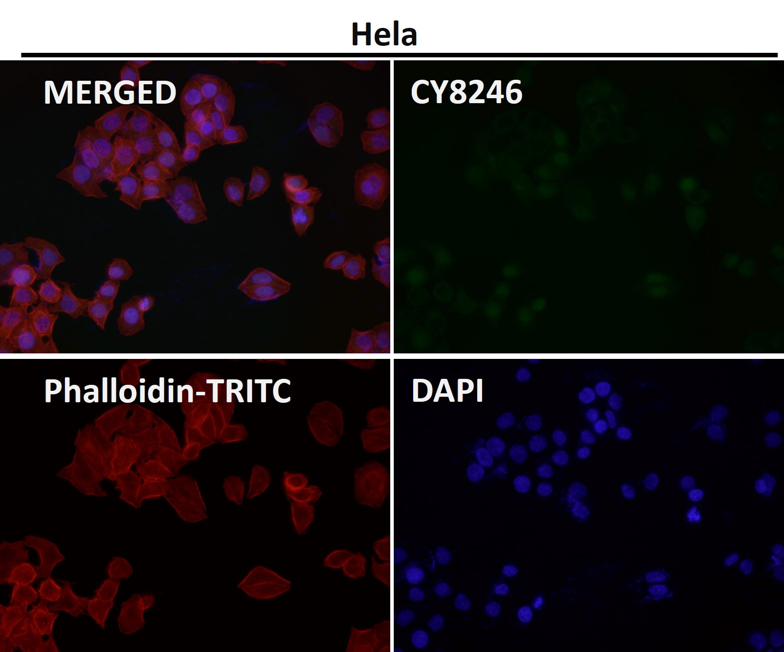 Rabbit Monoclonal to P70S6 Kinase beta