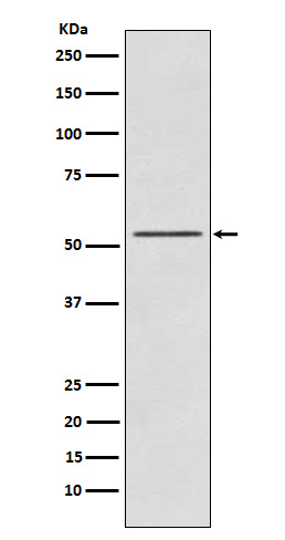 P70S6 Kinase beta