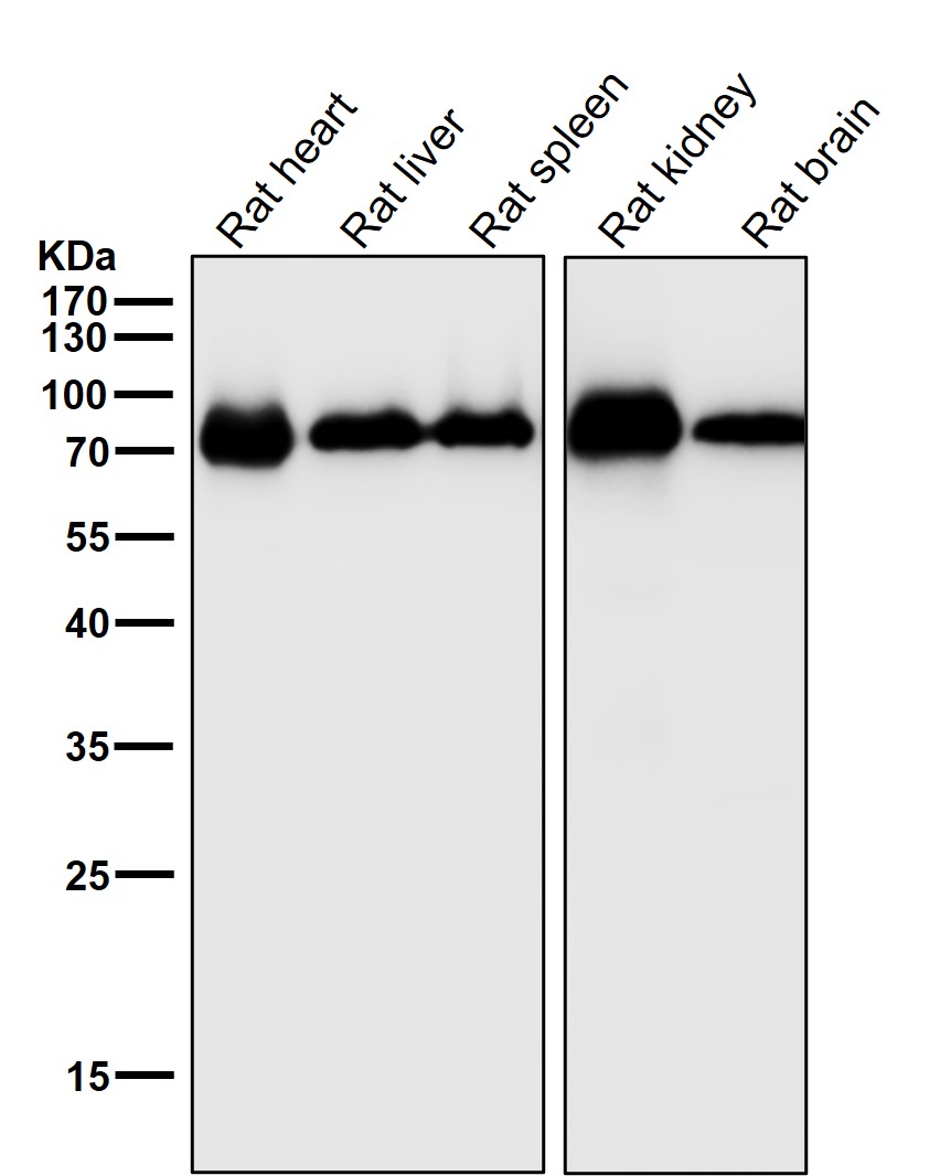 CYP1B1