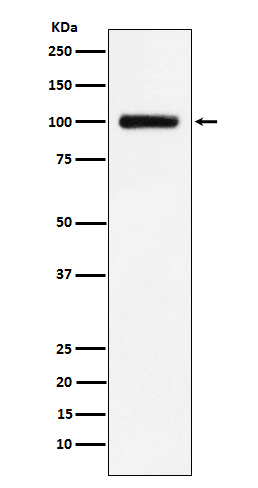 Transferrin Receptor 2