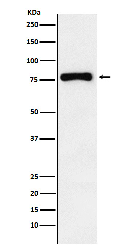RNaseL