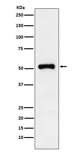 Retinoic Acid Receptor gamma