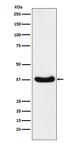 AKR1C3
