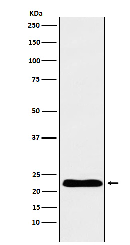 TNNI1