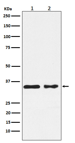 CSNK1A1