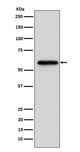 Retinoic Acid Receptor beta