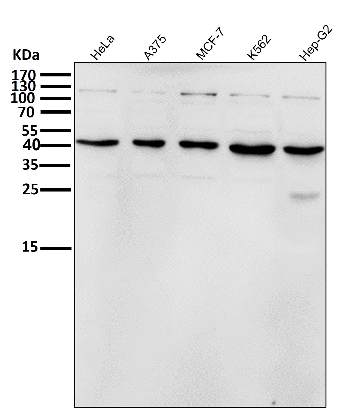 Inhibin beta A