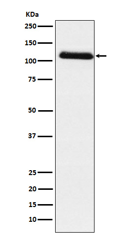 Fibrinogen alpha chain