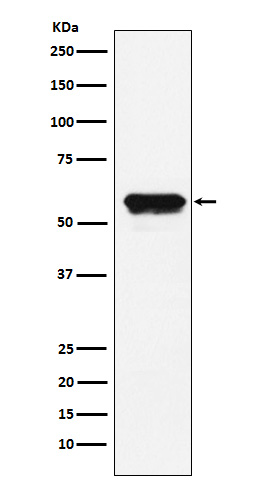 Angiotensinogen