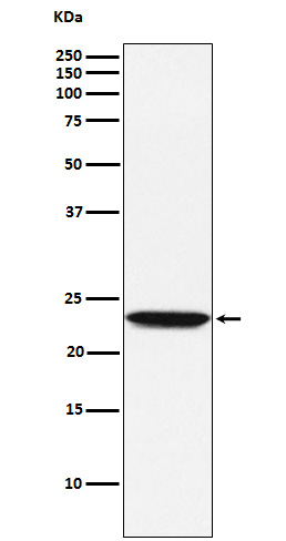 Tetranectin