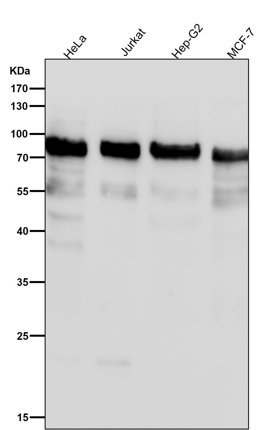 Phospho-UBF1(S484)