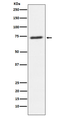 SENP1