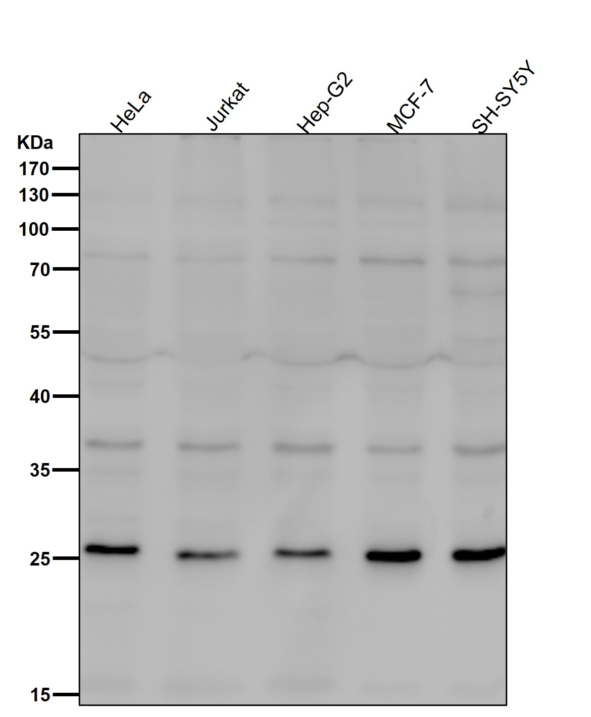 Neurogenin 2