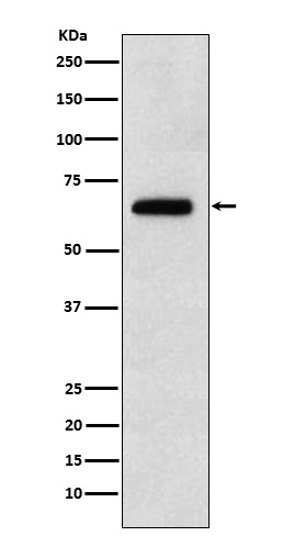 EBF1