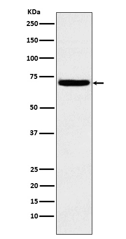 Heparanase1
