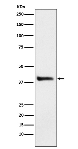 Alcohol Dehydrogenase