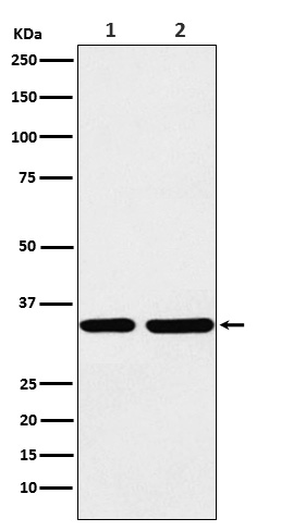 STUB1