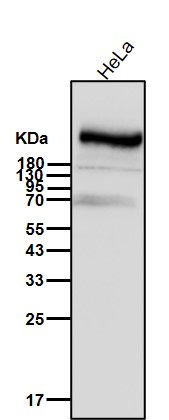 Rabbit Monoclonal to Smg1