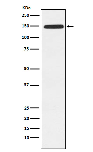 Xanthine Oxidase