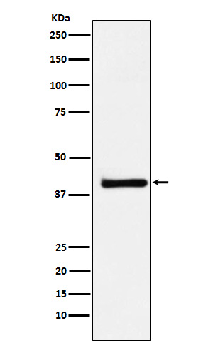 XRCC3