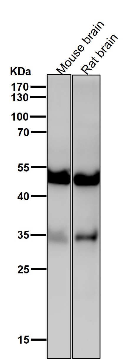 ACVR1B