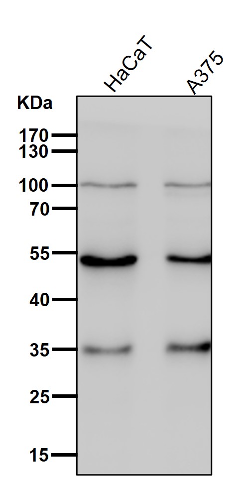 Rabbit Monoclonal to ACVR1B