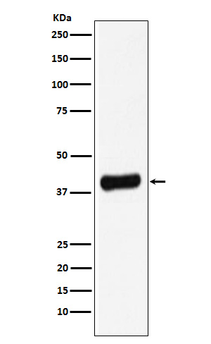 Galectin8