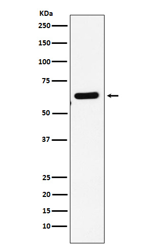 EHD1