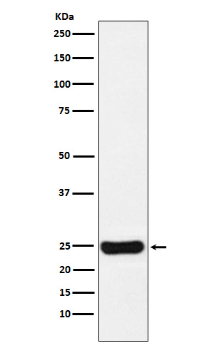 Cathepsin S