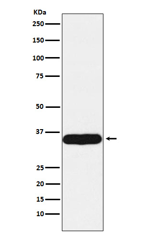 Tropomyosin 1