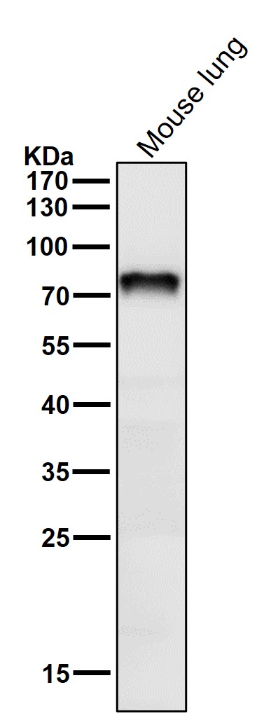Netrin 1