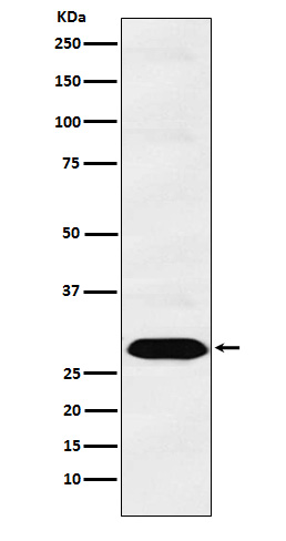 PSMA1