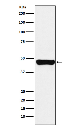 RCC1