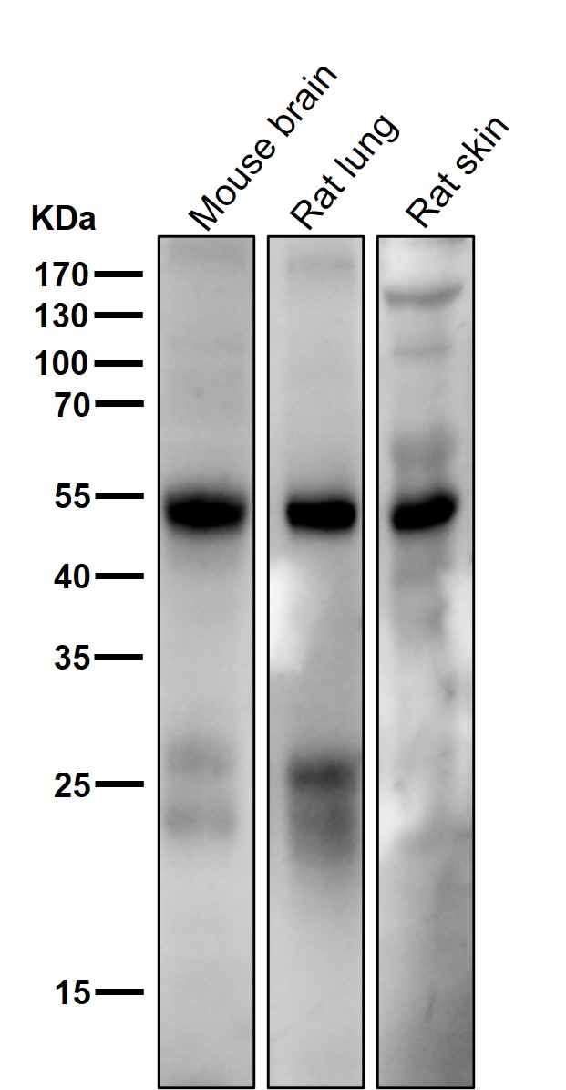 5HT7 Receptor