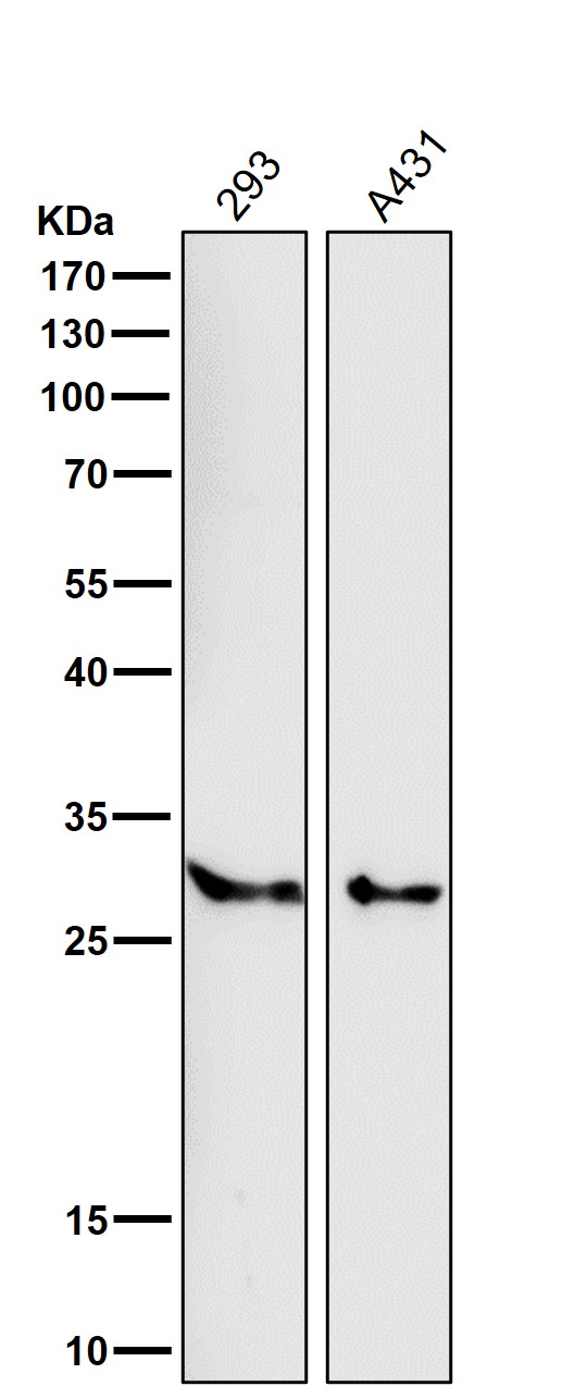 SRD5A2