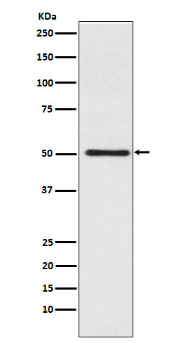 Cytochrome P450 17A1